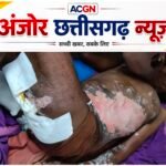 नकटीखार में बिजली खंभे पर करंट हादसा निजी युवक से कराया जा रहा था लाइन कार्य सीएसपीडीसीएल पर उठे गंभीर सवाल