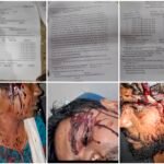 रहस्यमय हालात में खूनी संघर्ष, जमीन विवाद के पीछे छिपा कौन सा राज? चाकू-डंडे और लोहे की छड़ से हमला, 10 नामजद पर एफआईआर