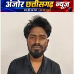 मासूम पर सितम की हद! सिगरेट से दागने का आरोप, सौतेला पिता-मां गिरफ्तार